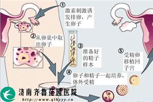 有谁愿意关注广州航空航天大学附属医院供卵试管婴儿的全过程？