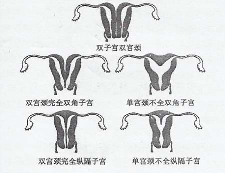 做赠卵试管婴儿会影响你的工作吗？