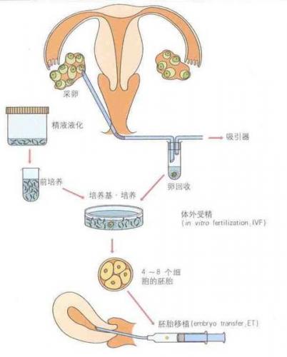 女性接受借精供卵有什么要求？应注意这几点