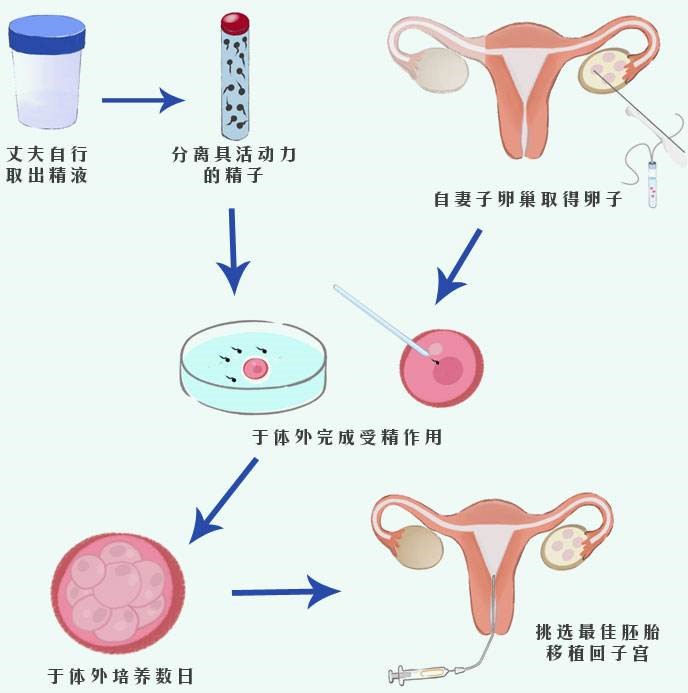 厦门供卵包成功不排队医院有哪些厦门供卵借卵试管医院怎么选择