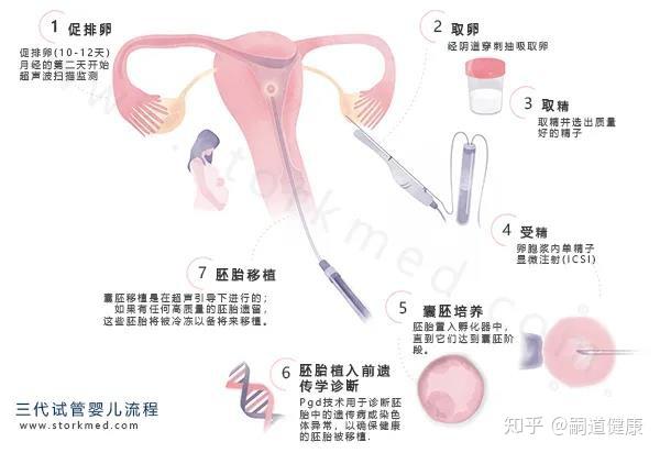 广州哪里做供卵试管