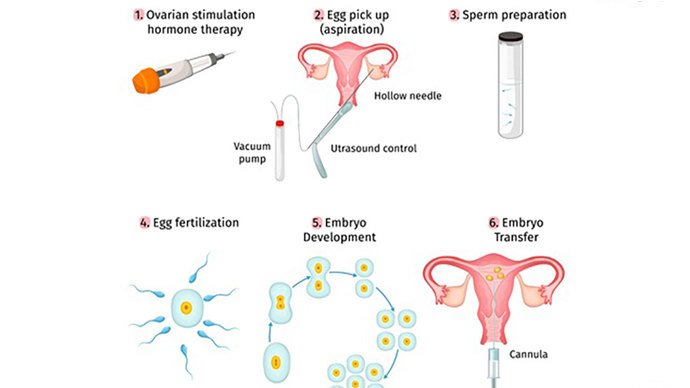 做借卵试管婴儿人工授精有什么区别