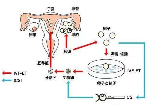 做试管婴儿男方取精大概需要多久