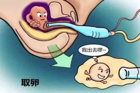 广州妇幼试管婴儿费用