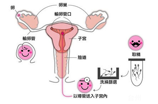 供卵试管代怀地址广州市哪家最好_广州爱维医院试管成功率能不能达到100%？上甜丁帮你解决生殖问题