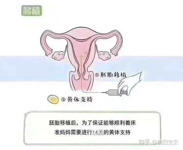 广州妇幼保健院做三代试管代怀要好多费用(广州市妇幼保健院做三代神州试管代怀网吗)