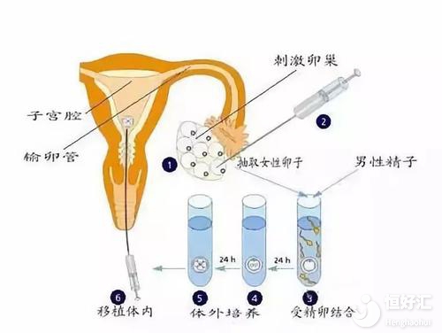 找个试管代怀的女孩过程中男性到底是如何取精的+需要注意哪些事项+