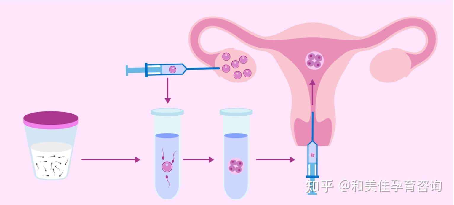 有没有胖子做试管成功的