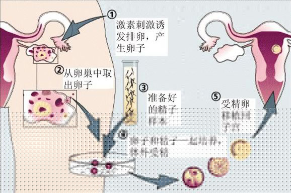 44岁想生二胎如何备孕怀孕几率更大