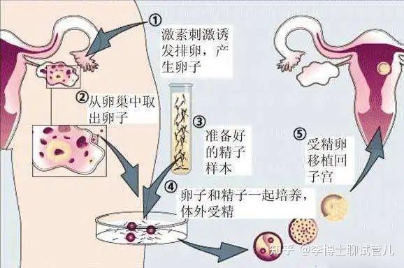 2024广州供卵试管代怀孩子机构医院最新排名,费用真没你想的那么高