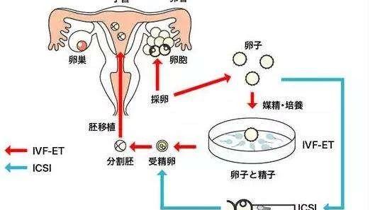 如何降低fsh值提高卵巢功能+从这5方面入手提高卵巢机能