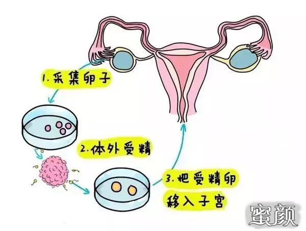 2024广州市第一人民医院国内供卵全包试管代怀婴儿需要多少钱（附试管生男孩费用一览）