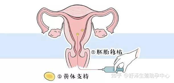 2024在国内公立医院做一次医院代生孩子全包费用要多少钱