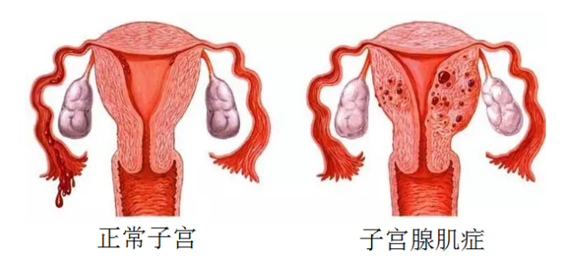 百度医生在线问诊会有记录吗_国际试管代怀妈妈如何收费婴儿费用、胜利率多少（广州市内姐妹孕前必读）