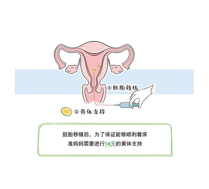 2024年广州哪个医院可以做失独助孕